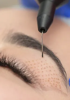 plasmapen etetica natural isabel cordero