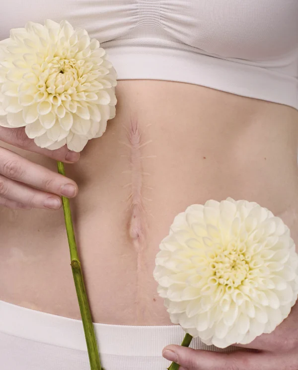 cicatrices destacada isabel cordero