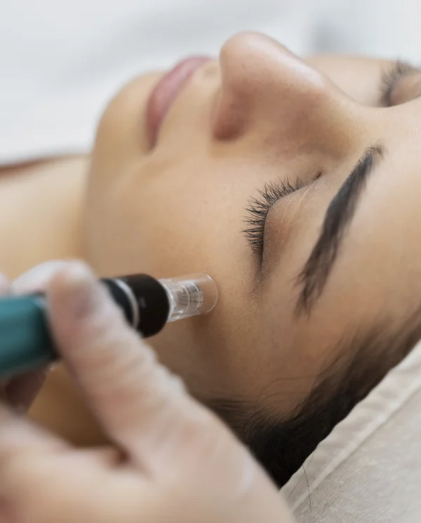 dermapen destacadas isabel cordero