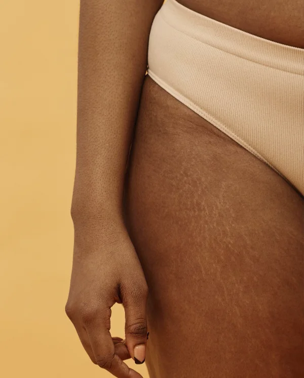 estrias destacada isabel cordero