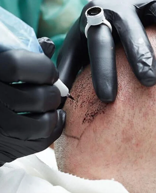 densidad capilar destacada isabel cordero