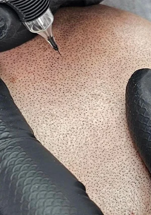 densidad capilar isabel cordero